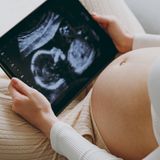 VERAgene - genetic prenatal test