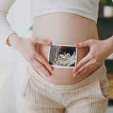 VERACITY 4 Premium – nieinwazyjne badania prenatalne